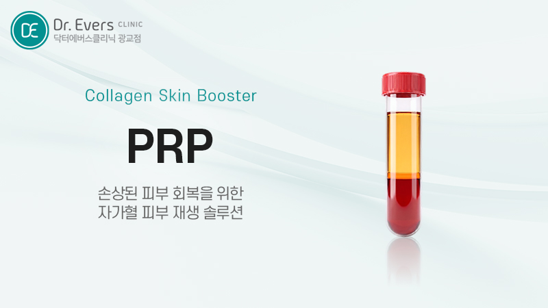 PRP 세포재생주사 진행과정, 주의사항_닥터에버스의원 광교 피부과