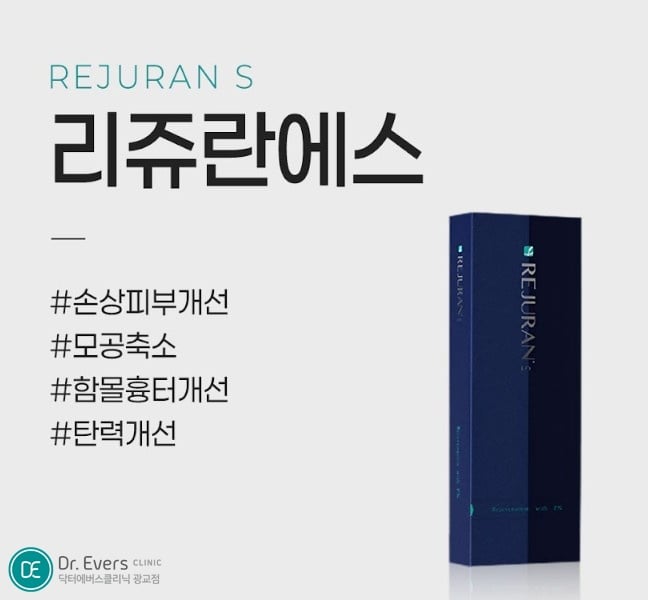 리쥬란 에스 광교피부과 닥터에버스